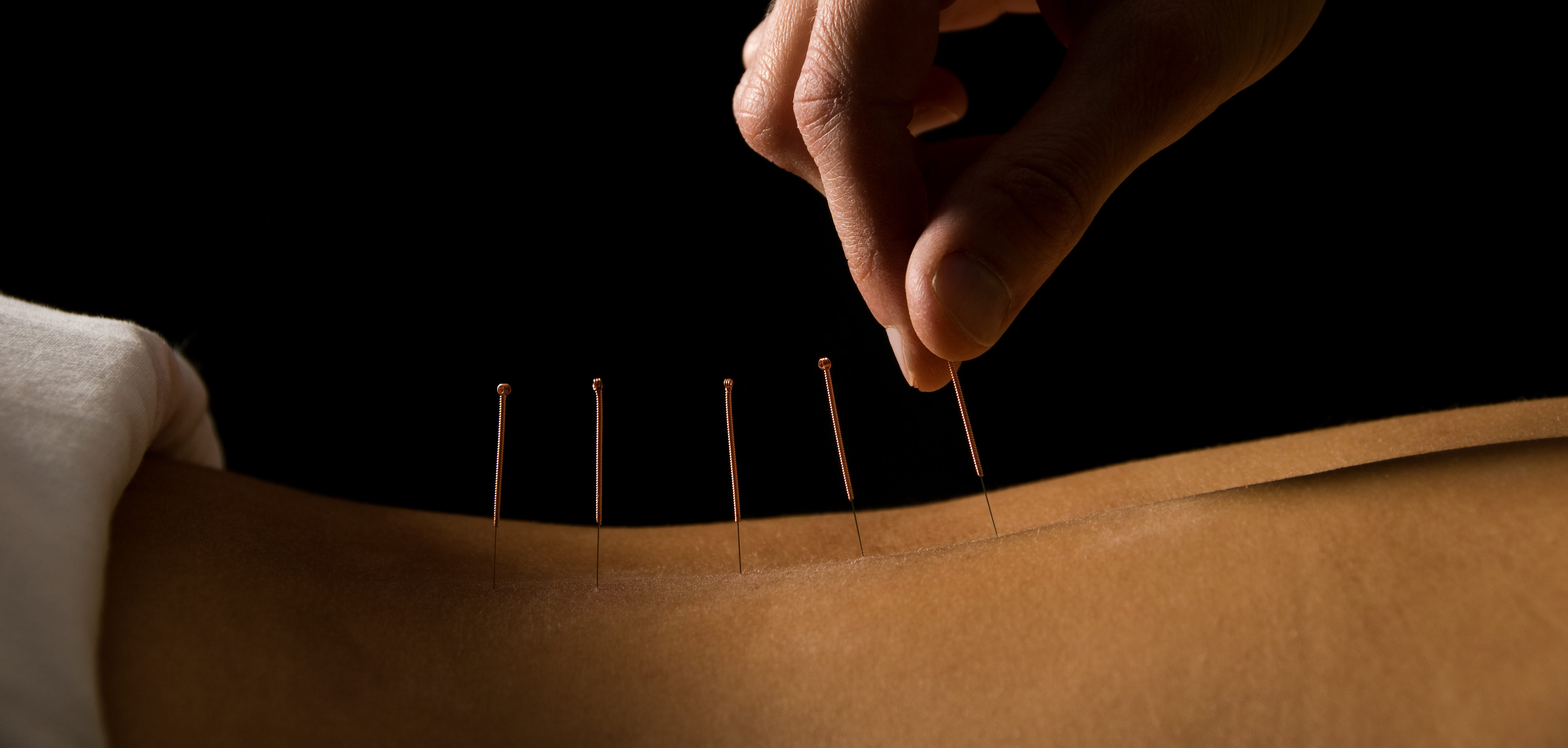 Acupuncture Vs Acupressure What You Need To Know Purple Carrot 2575